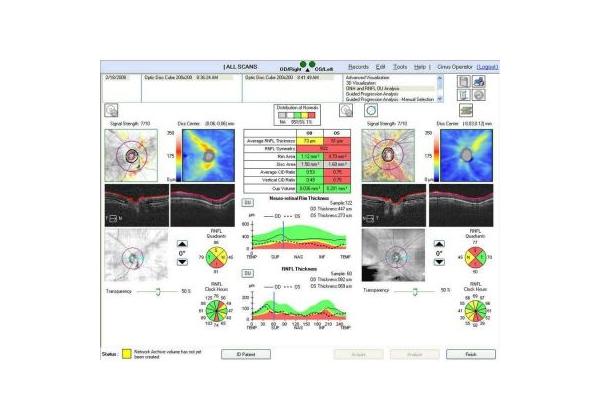 АППАРАТ ДЛЯ ОКТ ZEISS CIRRUS HD 4000 OCT